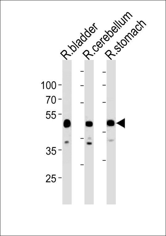 CBWD1 Antibody - Rat Cbwd1 Antibody western blot of rat bladder,cerebellum and stomach tissue lysates (35 ug/lane). The Rat Cbwd1 antibody detected the Rat Cbwd1 protein (arrow).