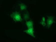 CBWD1 Antibody - Anti-CBWD1 mouse monoclonal antibody  immunofluorescent staining of COS7 cells transiently transfected by pCMV6-ENTRY CBWD1.