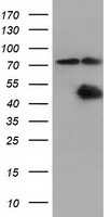 CBWD1 Antibody - HEK293T cells were transfected with the pCMV6-ENTRY control (Left lane) or pCMV6-ENTRY CBWD1 (Right lane) cDNA for 48 hrs and lysed. Equivalent amounts of cell lysates (5 ug per lane) were separated by SDS-PAGE and immunoblotted with anti-CBWD1.