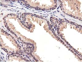 CBWD1 Antibody - IHC of paraffin-embedded Human prostate tissue using anti-CBWD1 mouse monoclonal antibody.