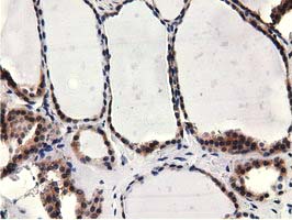 CBWD1 Antibody - IHC of paraffin-embedded Human thyroid tissue using anti-CBWD1 mouse monoclonal antibody.