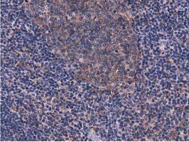 CBWD1 Antibody - IHC of paraffin-embedded Human lymph node tissue using anti-CBWD1 mouse monoclonal antibody.