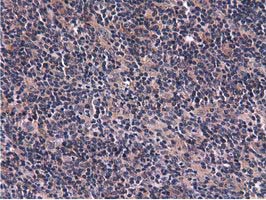 CBWD1 Antibody - IHC of paraffin-embedded Human lymphoma tissue using anti-CBWD1 mouse monoclonal antibody.
