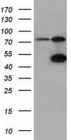 CBWD1 Antibody - HEK293T cells were transfected with the pCMV6-ENTRY control (Left lane) or pCMV6-ENTRY CBWD1 (Right lane) cDNA for 48 hrs and lysed. Equivalent amounts of cell lysates (5 ug per lane) were separated by SDS-PAGE and immunoblotted with anti-CBWD1.