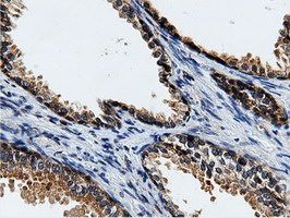 CBWD1 Antibody - Immunohistochemical staining of paraffin-embedded Human prostate tissue using anti-CBWD1 mouse monoclonal antibody.