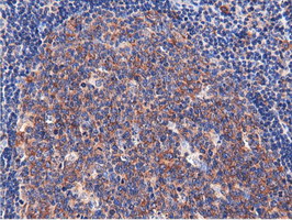 CBWD1 Antibody - Immunohistochemical staining of paraffin-embedded Human lymph node tissue using anti-CBWD1 mouse monoclonal antibody.