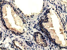 CBWD1 Antibody - Immunohistochemical staining of paraffin-embedded Human prostate tissue using anti-CBWD1 mouse monoclonal antibody.