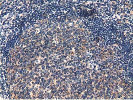 CBWD1 Antibody - Immunohistochemical staining of paraffin-embedded Human lymph node tissue using anti-CBWD1 mouse monoclonal antibody.