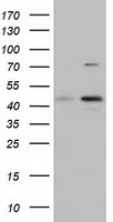 CBWD1 Antibody - HEK293T cells were transfected with the pCMV6-ENTRY control (Left lane) or pCMV6-ENTRY CBWD1 (Right lane) cDNA for 48 hrs and lysed. Equivalent amounts of cell lysates (5 ug per lane) were separated by SDS-PAGE and immunoblotted with anti-CBWD1.