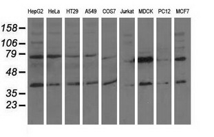 CBWD1 Antibody - Western blot of extracts (35 ug) from 9 different cell lines by using anti-CBWD1 monoclonal antibody.