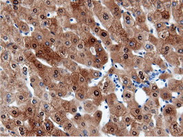 CBWD1 Antibody - Immunohistochemical staining of paraffin-embedded Human liver tissue using anti-CBWD1 mouse monoclonal antibody.