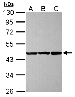 CBWD1 Antibody - Sample (30 ug of whole cell lysate) A: NT2D1 B: IMR32 C: U87-MG 10% SDS PAGE CBWD1 antibody diluted at 1:1000