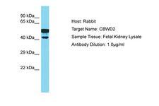 CBWD2 Antibody -  This image was taken for the unconjugated form of this product. Other forms have not been tested.