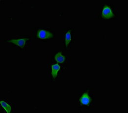 CBWD2 Antibody - Immunofluorescent analysis of Hela cells using CBWD2 Antibody at dilution of 1:100 and Alexa Fluor 488-congugated AffiniPure Goat Anti-Rabbit IgG(H+L)