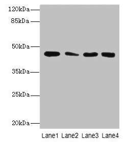 CBWD2 Antibody - Western Blot All lanes: CBWD2 antibody at 6µg/ml Lane 1: Mouse heart tissue Lane 2: Mouse liver tissue Lane 3: Mouse lung tissue Lane 4: Hela whole cell lysate Secondary Goat polyclonal to rabbit IgG at 1/10000 dilution Predicted band size: 44 kDa Observed band size: 44 kDa