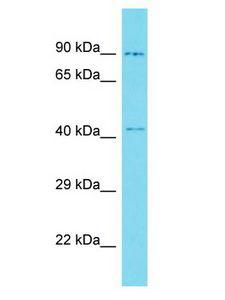 CBWD3 Antibody - CBWD3 antibody Western Blot of Fetal Kidney. Antibody dilution: 1 ug/ml.  This image was taken for the unconjugated form of this product. Other forms have not been tested.