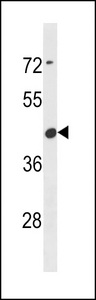CBWD6 Antibody - CBWD6 Antibody western blot of CEM cell line lysates (35 ug/lane). The CBWD6 antibody detected the CBWD6 protein (arrow).