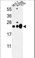 CBX1 / HP1 Beta Antibody - Western blot of CBX1 Antibody in MCF-7, A2058, Y79 cell line lysates (35 ug/lane). CBX1 (arrow) was detected using the purified antibody.