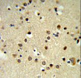 CBX1 / HP1 Beta Antibody - CBX1 Antibody IHC of formalin-fixed and paraffin-embedded brain tissue followed by peroxidase-conjugated secondary antibody and DAB staining.