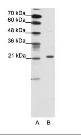 CBX1 / HP1 Beta Antibody - A: Marker, B: HepG2 Cell Lysate.  This image was taken for the unconjugated form of this product. Other forms have not been tested.