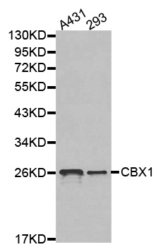 CBX1 / HP1 Beta Antibody - Western blot analysis of extracts of various cell lines, using CBX1 antibody.