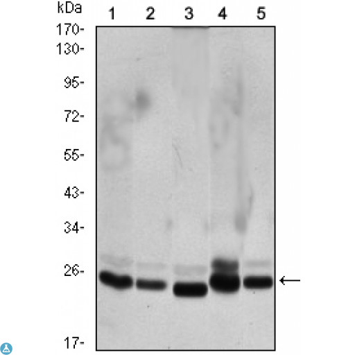 CBX1 / HP1 Beta Antibody - Western Blot (WB) analysis using CBX1 Monoclonal Antibody against HeLa (1), COS7 (2), NIH/3T3 (3), A431 (4),and C6 (5) cell lysate.