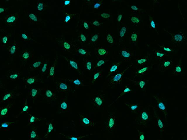 CBX1 / HP1 Beta Antibody - Immunofluorescence staining of CBX1 in HeLa cells. Cells were fixed with 4% PFA, permeabilzed with 0.1% Triton X-100 in PBS, blocked with 10% serum, and incubated with rabbit anti-Human CBX1 polyclonal antibody (dilution ratio 1:1000) at 4°C overnight. Then cells were stained with the Alexa Fluor 488-conjugated Goat Anti-rabbit IgG secondary antibody (green) and counterstained with DAPI (blue). Positive staining was localized to Nucleus.