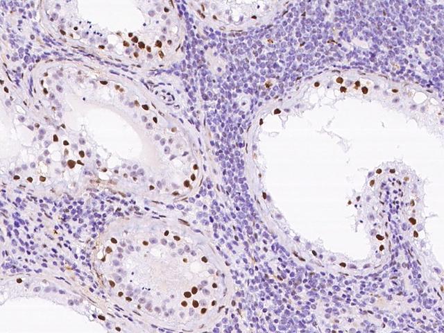 CBX1 / HP1 Beta Antibody - Immunochemical staining CBX1 in human testis with rabbit polyclonal antibody at 1:1000 dilution, formalin-fixed paraffin embedded sections.