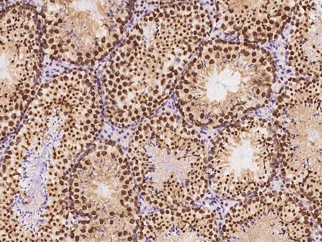 CBX1 / HP1 Beta Antibody - Immunochemical staining CBX1 in mouse testis with rabbit polyclonal antibody at 1:1000 dilution, formalin-fixed paraffin embedded sections.