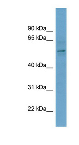 CBX2 Antibody - CBX2 antibody Western blot of OVCAR-3 cell lysate. This image was taken for the unconjugated form of this product. Other forms have not been tested.