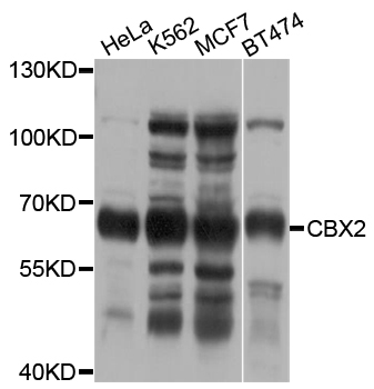 CBX2 Antibody - Western blot analysis of extracts of various cell lines.