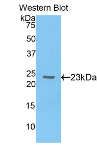 CBX3 / HP1 Gamma Antibody - Western blot of recombinant CBX3 / HP1 Gamma.  This image was taken for the unconjugated form of this product. Other forms have not been tested.