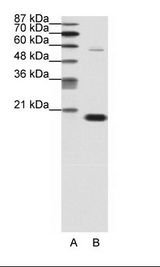 CBX3 / HP1 Gamma Antibody - A: Marker, B: Jurkat Cell Lysate.  This image was taken for the unconjugated form of this product. Other forms have not been tested.