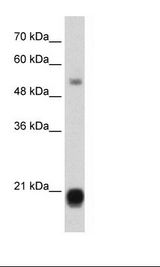 CBX3 / HP1 Gamma Antibody - Jurkat Cell Lysate.  This image was taken for the unconjugated form of this product. Other forms have not been tested.