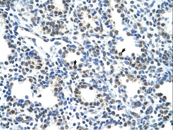 CBX3 / HP1 Gamma Antibody - CBX3 antibody ARP34721_T100-NP_057671-CBX3(chromobox homolog 3 (HP1 gamma homolog, Drosophila)) Antibody was used in IHC to stain formalin-fixed, paraffin-embedded human lung.  This image was taken for the unconjugated form of this product. Other forms have not been tested.