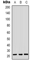 CBX3 / HP1 Gamma Antibody - Western blot analysis of HP1 gamma expression in HepG2 (A); HEK293T (B); HeLa (C) whole cell lysates.