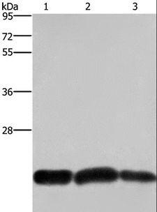 CBX3 / HP1 Gamma Antibody - Western blot analysis of A375 and Raji cell, human fetal brain tissue, using CBX3 Polyclonal Antibody at dilution of 1:600.