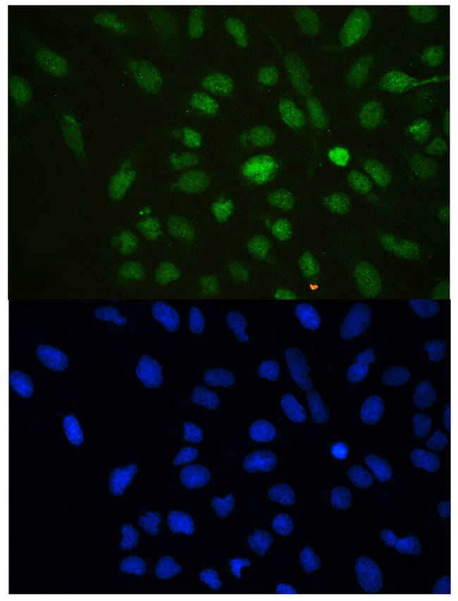CBX3 / HP1 Gamma Antibody - IF analysis of HP1 gamma using anti-HP1 gamma antibody HP1 gamma was detected in immunocytochemical section of U20S cell. Enzyme antigen retrieval was performed using IHC enzyme antigen retrieval reagent for 15 mins. The tissue section was blocked with 10% goat serum. The tissue section was then incubated with 2µg/mL rabbit anti-HP1 gamma Antibody overnight at 4°C. DyLight®488 Conjugated Goat Anti-Rabbit IgG was used as secondary antibody at 1:100 dilution and incubated for 30 minutes at 37°C. The section was counterstained with DAPI. Visualize using a fluorescence microscope and filter sets appropriate for the label used.
