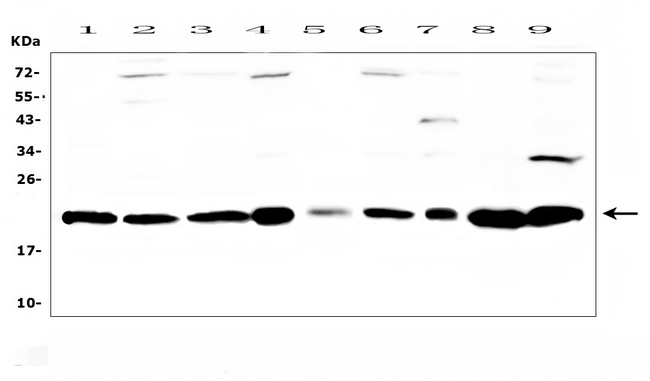 CBX3 / HP1 Gamma Antibody - Western blot analysis of HP1 gamma using anti-HP1 gamma antibody. Electrophoresis was performed on a 5-20% SDS-PAGE gel at 70V (Stacking gel) / 90V (Resolving gel) for 2-3 hours. The sample well of each lane was loaded with 50ug of sample under reducing conditions. Lane 1: rat brain tissue lysate,Lane 2: rat spleen tissue lysate,Lane 3: rat testis tissue lysate,Lane 4: rat PC-12 cell lysate,Lane 5: mouse brain tissue lysate,Lane 6: mouse spleen tissue lysate,Lane 7: mouse testis tissue lysate,Lane 8: mouse HEPA1-6 cell lysate,Lane 9: mouse NIH3T3 cell lysate. After Electrophoresis, proteins were transferred to a Nitrocellulose membrane at 150mA for 50-90 minutes. Blocked the membrane with 5% Non-fat Milk/ TBS for 1.5 hour at RT. The membrane was incubated with rabbit anti-HP1 gamma antigen affinity purified polyclonal antibody at 0.5 µg/mL overnight at 4°C, then washed with TBS-0.1% Tween 3 times with 5 minutes each and probed with a goat anti-rabbit IgG-HRP secondary antibody at a dilution of 1:10000 for 1.5 hour at RT. The signal is developed using an Enhanced Chemiluminescent detection (ECL) kit with Tanon 5200 system. A specific band was detected for HP1 gamma at approximately 21KD. The expected band size for HP1 gamma is at 21KD.