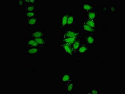 CBX3 / HP1 Gamma Antibody - Immunofluorescent analysis of HepG2 cells at a dilution of 1:100 and Alexa Fluor 488-congugated AffiniPure Goat Anti-Rabbit IgG(H+L)