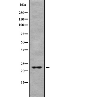 CBX3 / HP1 Gamma Antibody - Western blot analysis of HP1gamma using 293 whole cells lysates