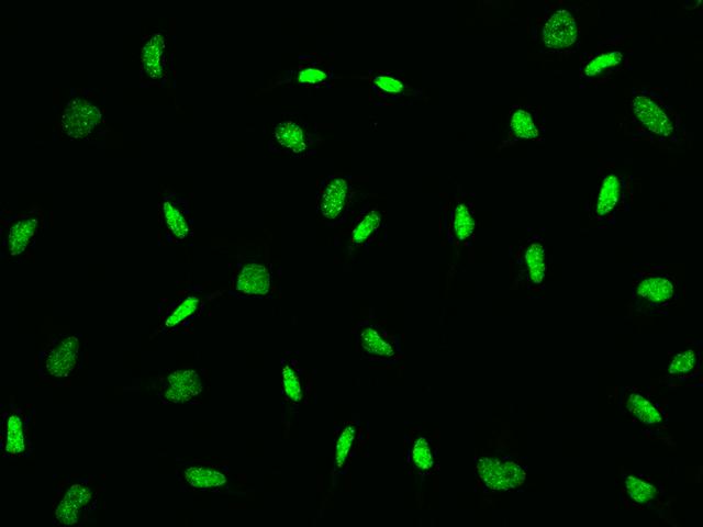 CBX3 / HP1 Gamma Antibody - Immunofluorescence staining of CBX3 in HeLa cells. Cells were fixed with 4% PFA, permeabilzed with 0.1% Triton X-100 in PBS, blocked with 10% serum, and incubated with rabbit anti-Human CBX3 polyclonal antibody (dilution ratio 1:1000) at 4°C overnight. Then cells were stained with the Alexa Fluor 488-conjugated Goat Anti-rabbit IgG secondary antibody (green).