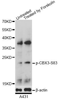 CBX3 / HP1 Gamma Antibody - Western blot analysis of extracts of A431 cells, using Phospho-CBX3-S83 antibody at 1:2000 dilution. A431 cells were treated by Forskolin (10uM) for 30 minutes after serum-starvation overnight. The secondary antibody used was an HRP Goat Anti-Rabbit IgG (H+L) at 1:10000 dilution. Lysates were loaded 25ug per lane and 3% nonfat dry milk in TBST was used for blocking. Blocking buffer: 3% BSA.An ECL Kit was used for detection and the exposure time was 90s.