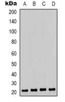 CBX3 / HP1 Gamma Antibody - Western blot analysis of HP1 gamma (pS93) expression in Jurkat (A); K562 (B); A431 (C); Raw264.7 (D) whole cell lysates.