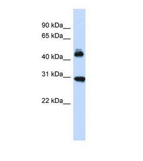 CBX4 Antibody - Western blot of Human Fetal Brain. CBX4 antibody dilution 1.0 ug/ml.  This image was taken for the unconjugated form of this product. Other forms have not been tested.