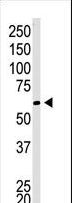 CBX4 Antibody - The anti-CBX4 C-term antibody is used in Western blot to detect CBX4 in Jurkat cell lysate.