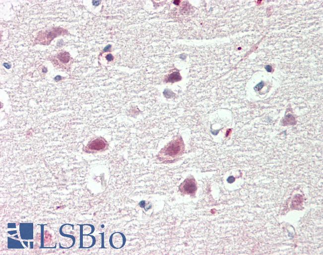 CBX4 Antibody - Human Brain, Cortex: Formalin-Fixed, Paraffin-Embedded (FFPE).  This image was taken for the unconjugated form of this product. Other forms have not been tested.