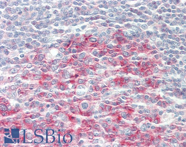 CBX4 Antibody - Human Tonsil: Formalin-Fixed, Paraffin-Embedded (FFPE).  This image was taken for the unconjugated form of this product. Other forms have not been tested.