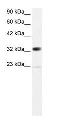 CBX4 Antibody - Jurkat Cell Lysate.  This image was taken for the unconjugated form of this product. Other forms have not been tested.