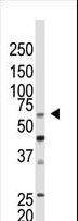 CBX4 Antibody - The anti-CBX4 N-term antibody is used in Western blot to detect CBX4 in mouse kidney tissue lysate.